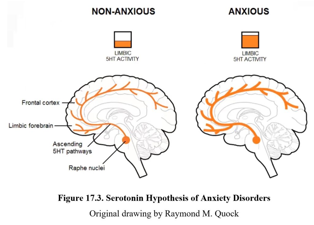 hypothesis about anxiety