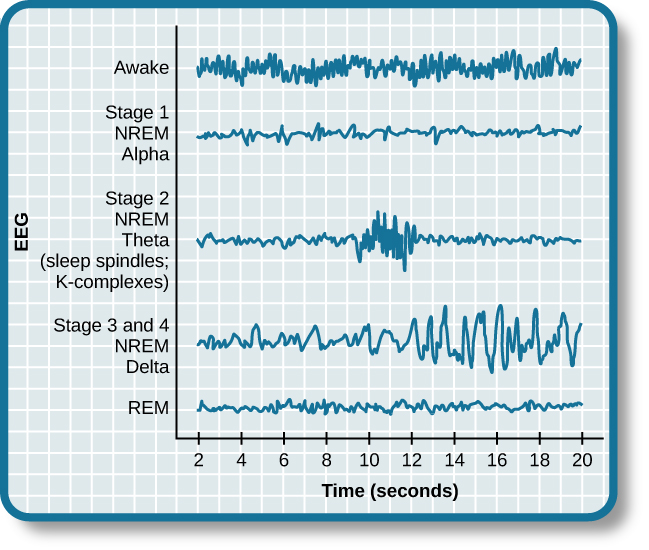 deep sleep brain wave frequency